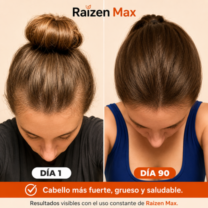 Raizen Max - Detiene la Caída del Pelo y Estimula el Crecimiento de Raíz.